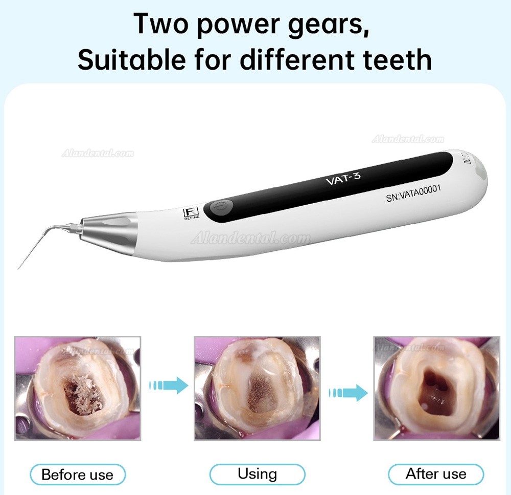 REFINE VAT-3 Dental Endo Ultra Activator (Ultrasonic Activation)